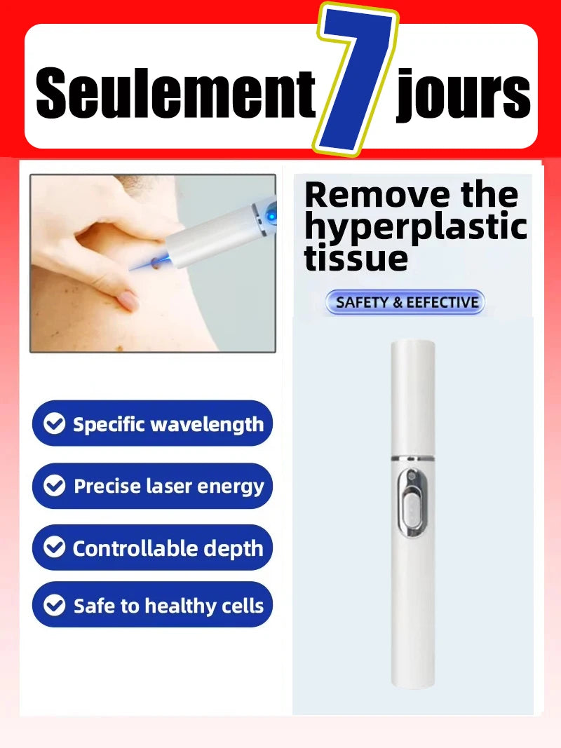 Foot Exfoliating Laser Pen - Professional Home Spa Skin Care Tool Relaxation Treatment Tidesmit