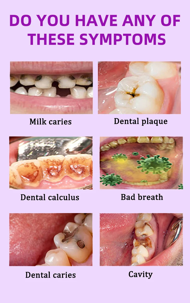 Tidesmit anti-caries teeth whitening treatment for healing cavities and strengthening enamel