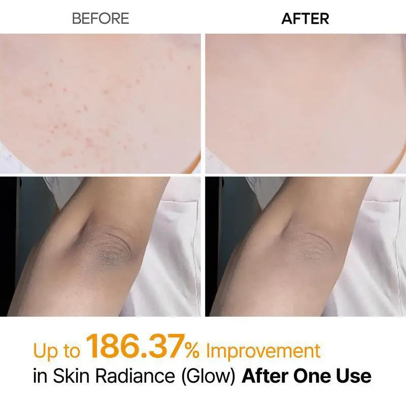 Kojic Acid Turmeric Body Scrub Spray | Natural Exfoliating 200ml Scrubs Treatments Tidesmit