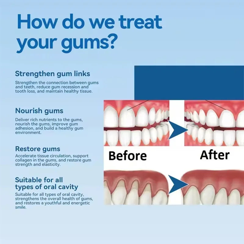 Gum Repair Gel for Sensitivity Relief and Deep Cleaning by Tidesmit Lip Care Tidesmit