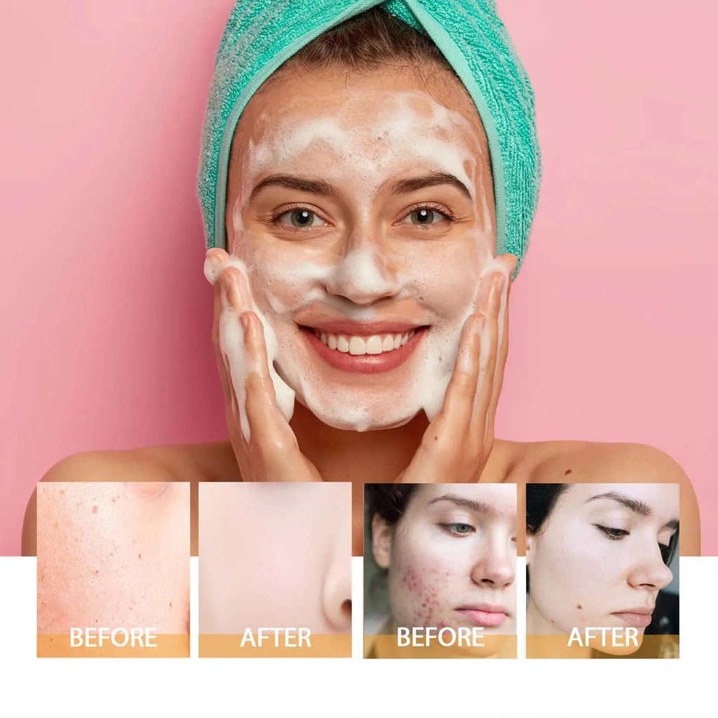 Pro Turmeric Face Wash Mild Foaming & Smooth Touch Fast Cleansing Daily Skin Prep Portable Beauty Tool for All Skin Types