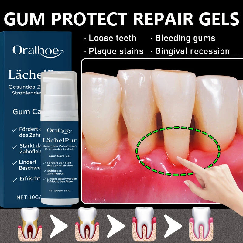 Tidesmit Damaged Gum Repair Care Gel for deep cleaning teeth stains, tartar removal, and sore gum relief.