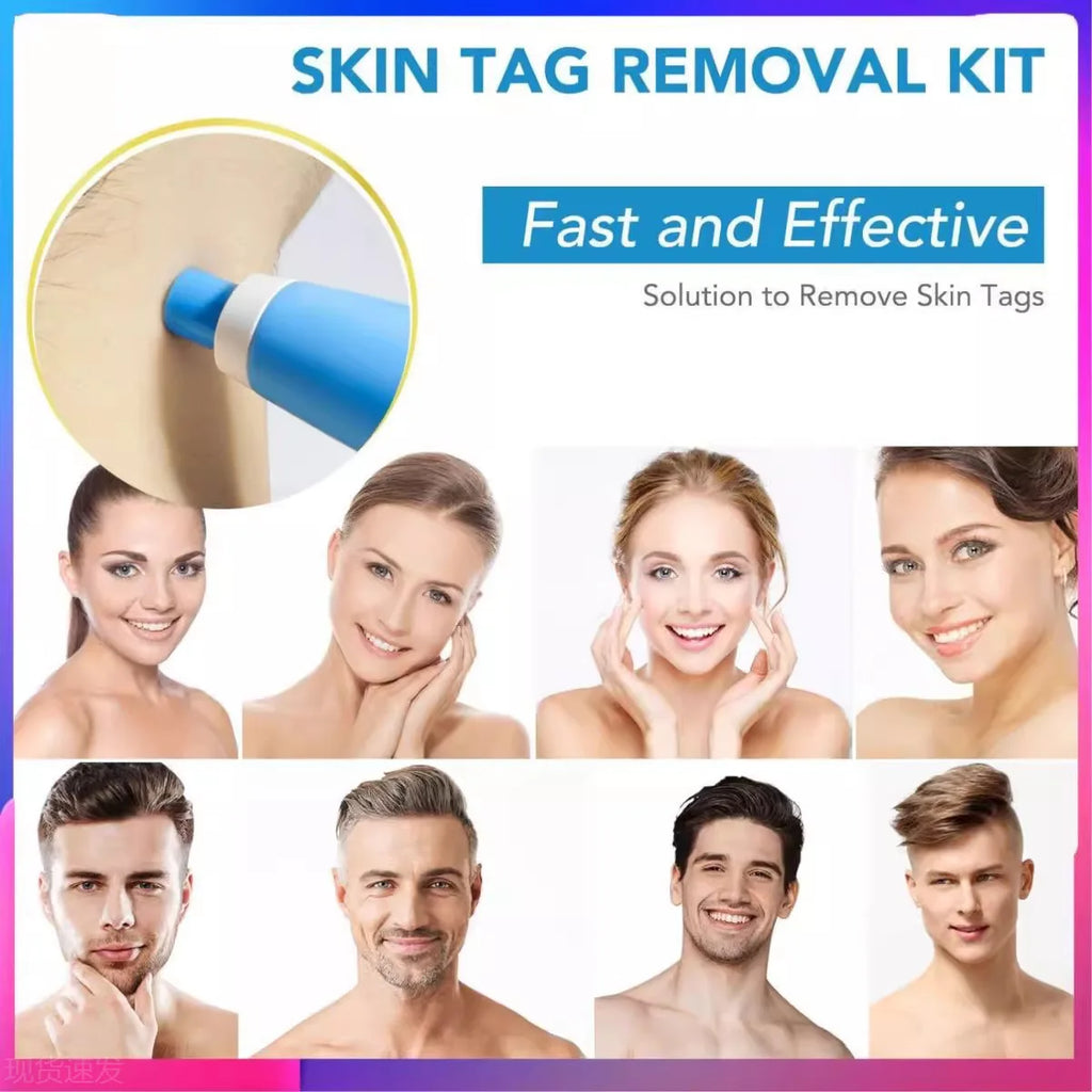 2-in-1 painless skin tag removal kit with blue applicator device, for fast, effective home mole and wart treatment.