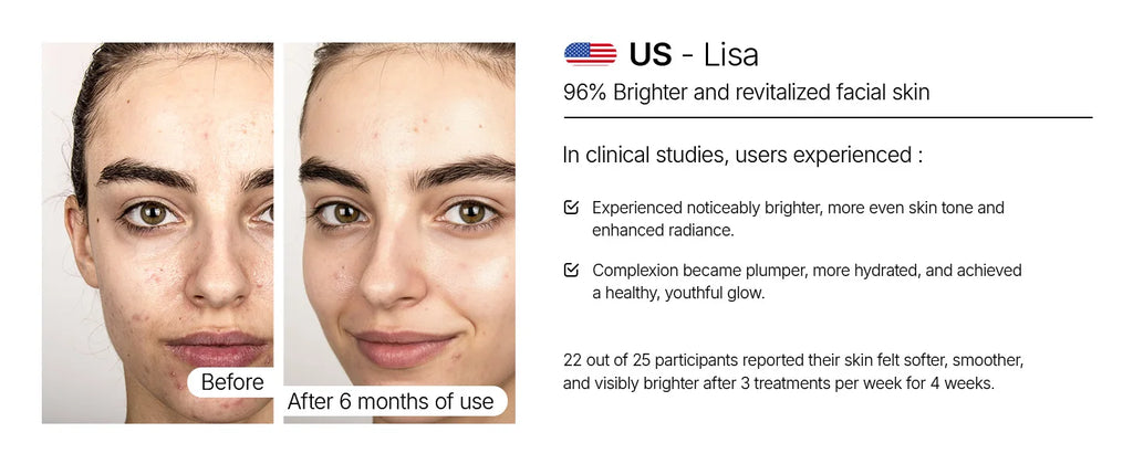 Before and after comparison of a woman's face showing improved skin texture and brightness after skincare treatment.