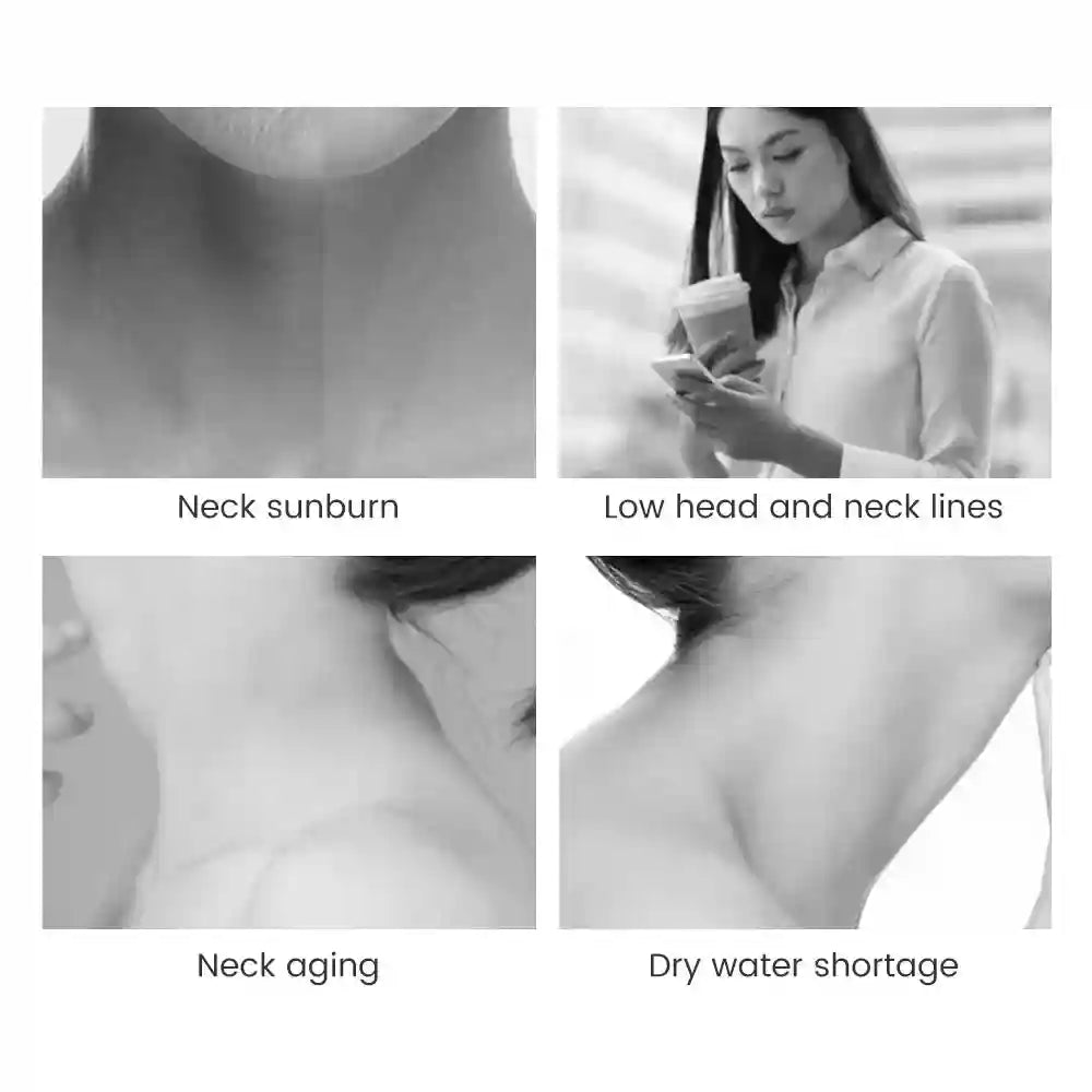 Four black-and-white photos showing neck skin conditions like sunburn, wrinkles, aging, and dryness.
