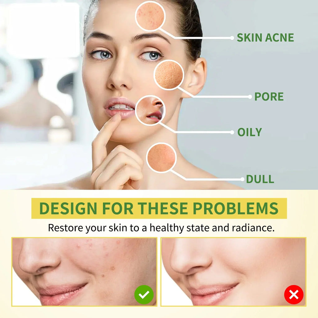 Turmeric Brightening Gel | Pore Minimizing Treatment 120g Scrubs Treatments Tidesmit