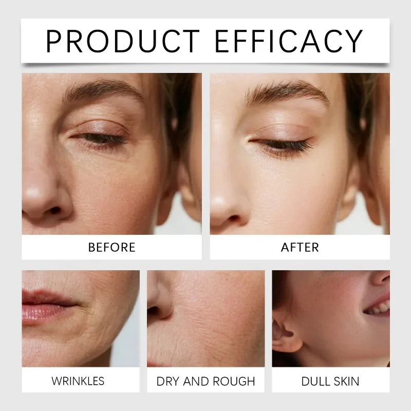 Before and after results for micro infusion serum kit showing improved skin texture, reduced wrinkles, and radiance.