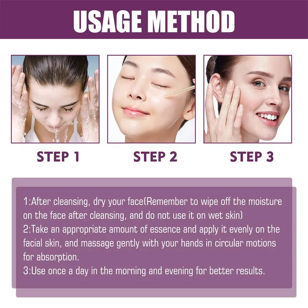 Niacinamide Serum 20% High Concentration Formula Serum Brightens Lightens Spots Niacinamide Care Serum Lifts Nasal Lines