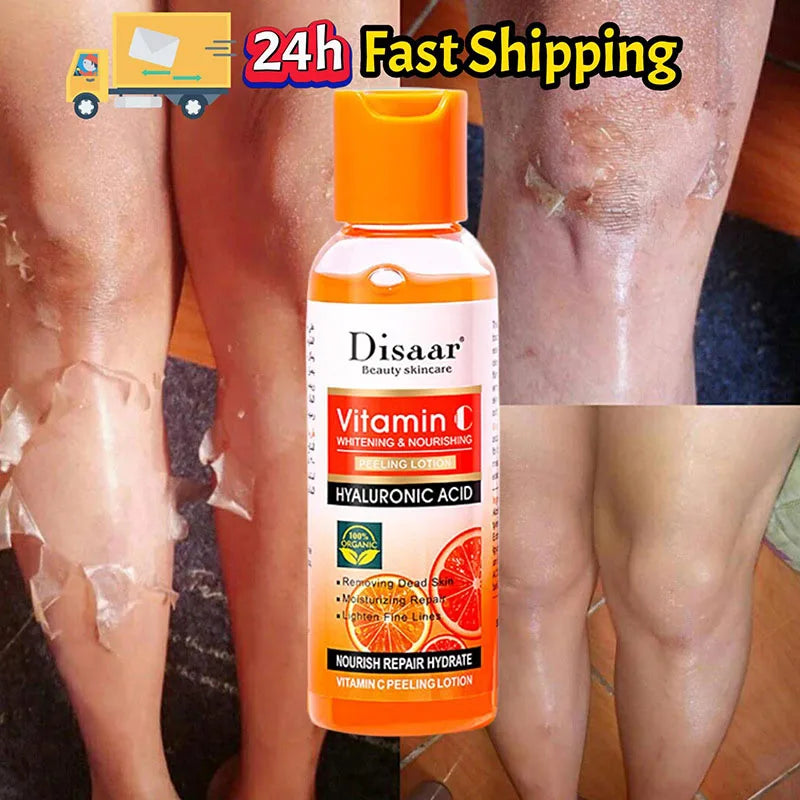Yellow Peeling Oil for Dark Skin - Professional Exfoliating Treatment Scrubs Treatments 100ml(1pc) Tidesmit