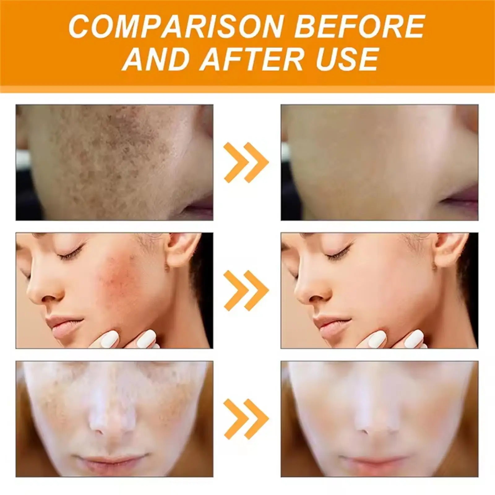 Turmeric Freckle Removing Whitening Essence Fade Pigmentation Melasma Dark Spots Corrector Repair Serum Korean Skin Care