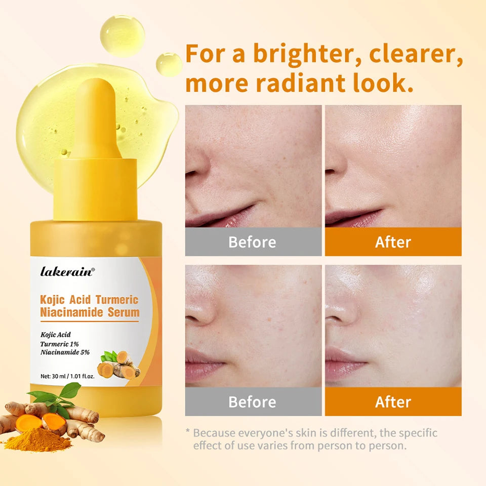 Kojic Acid Turmeric Niacinamide Serum Precise Dropper Design Deep Moisturizing Soothe Skin Brighten Skin Tone Facial Care