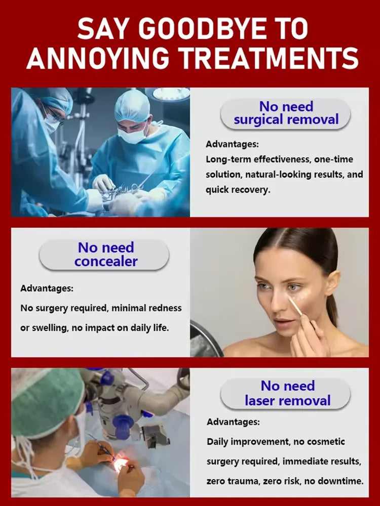 Eye Bag Remover Cream: Professional Depuffing Treatment for Tired Eyes Relaxation Treatment Tidesmit