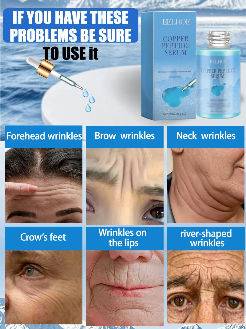 Copper peptide serum in a light blue glass bottle with a dropper, designed to treat facial and neck wrinkles.