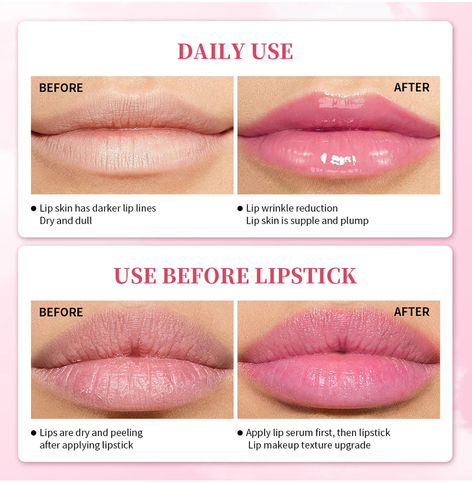 Lip Lightening Serum for Dark Lips - Hydrating Repair Treatment Lip Care Tidesmit