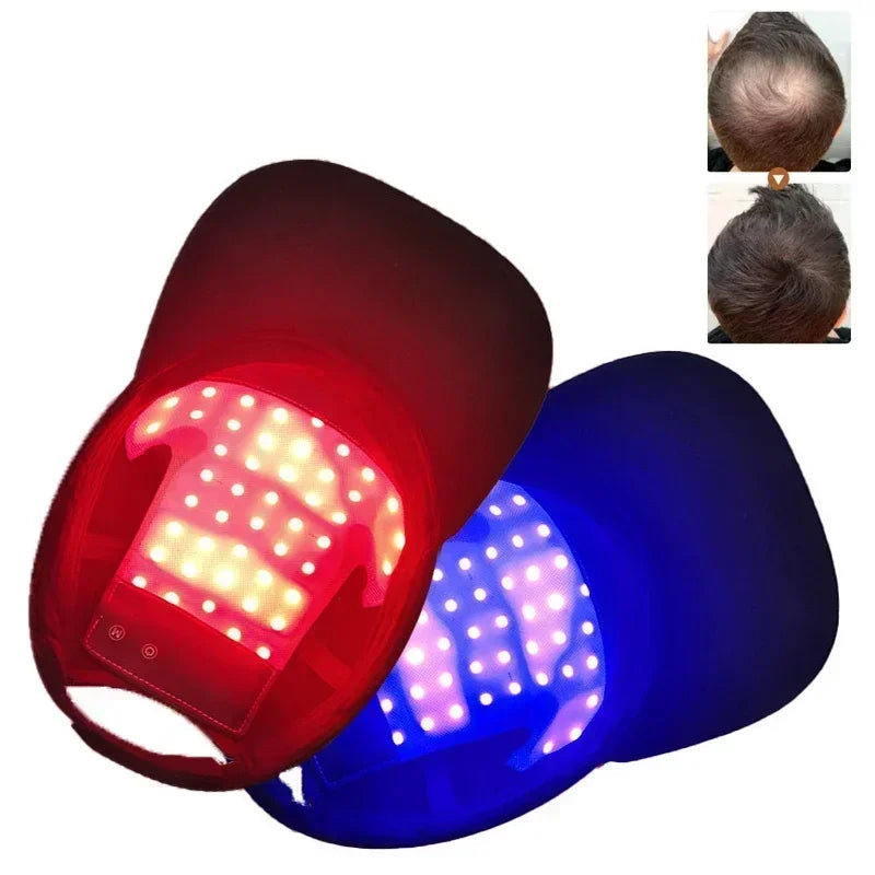 Red Light Therapy For Hair Fast Growth Cap Red&Infrared Light Therapy Device For Hair Loss Treatment With USB Charging Anti-hair