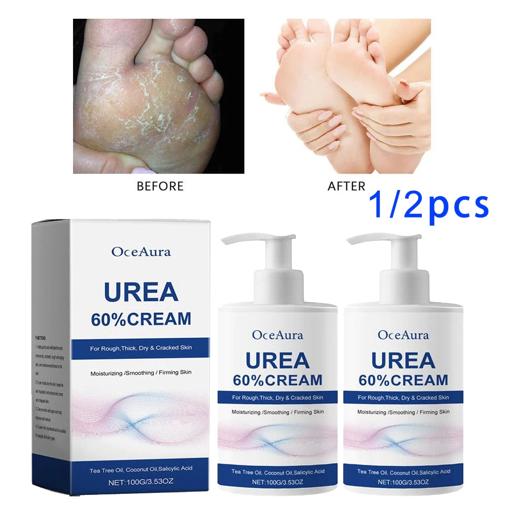 Urea 60% Cream for Cracked Heels - Professional Deep Foot Repair Scrubs Treatments Tidesmit