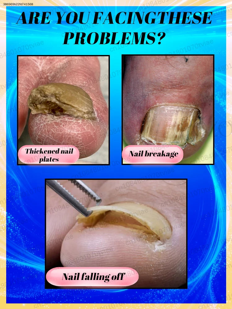Exfoliating Body Scrub for Mobility Support - Professional Skin Treatment Scrubs Treatments Tidesmit