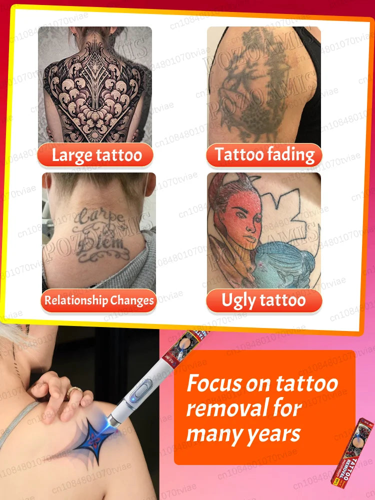 Nano Laser Tattoo Removal Pen for PMU and Pigmentation Treatment Permanent Makeup Machines Tidesmit