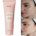 Fruit Acid Peeling Gel for Deep Pore Cleansing - Tidesmit 100ml Scrubs Treatments Default Title Tidesmit