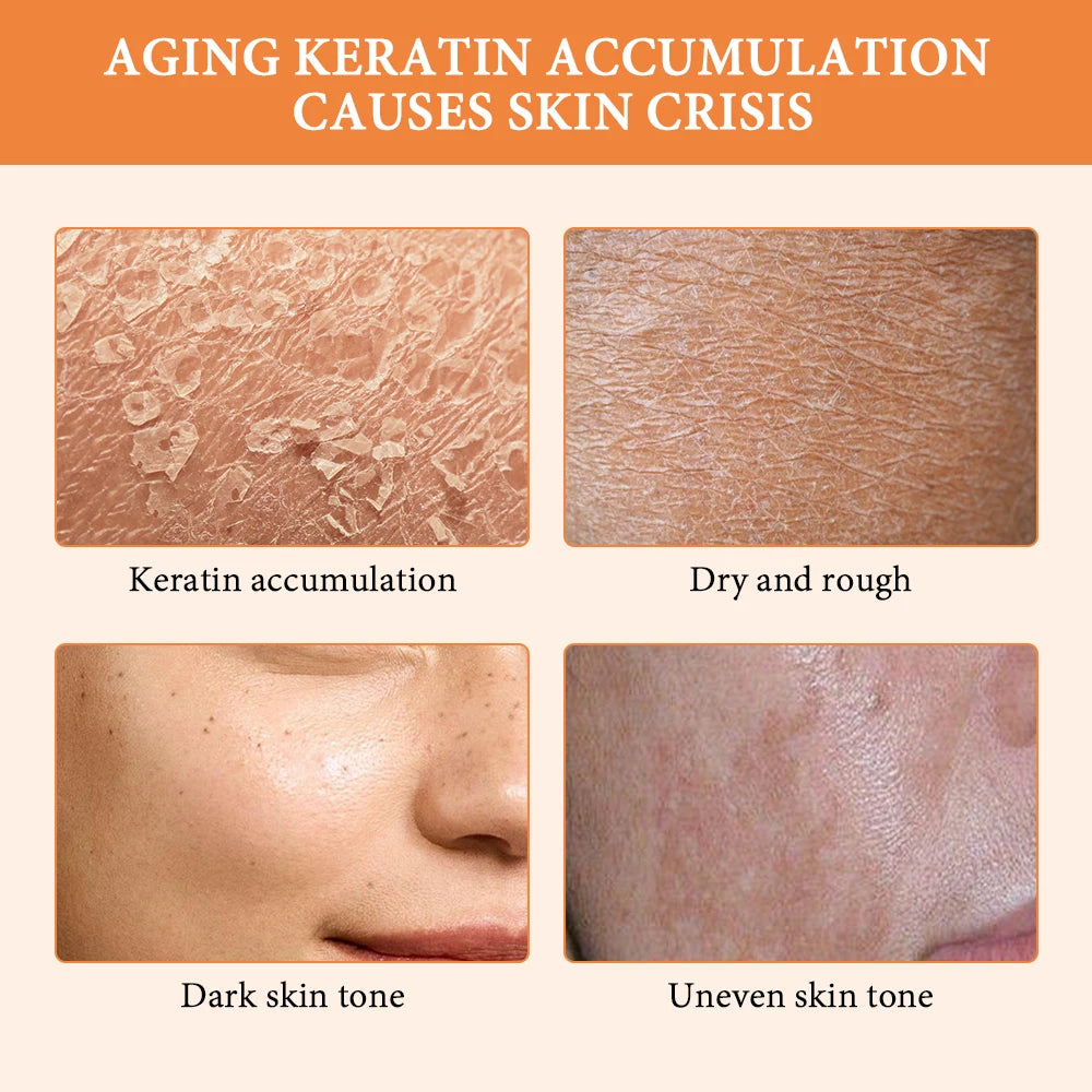 Orange Peeling Gel Body Exfoliator - Natural Deep Cleansing 50g Scrubs Treatments Tidesmit