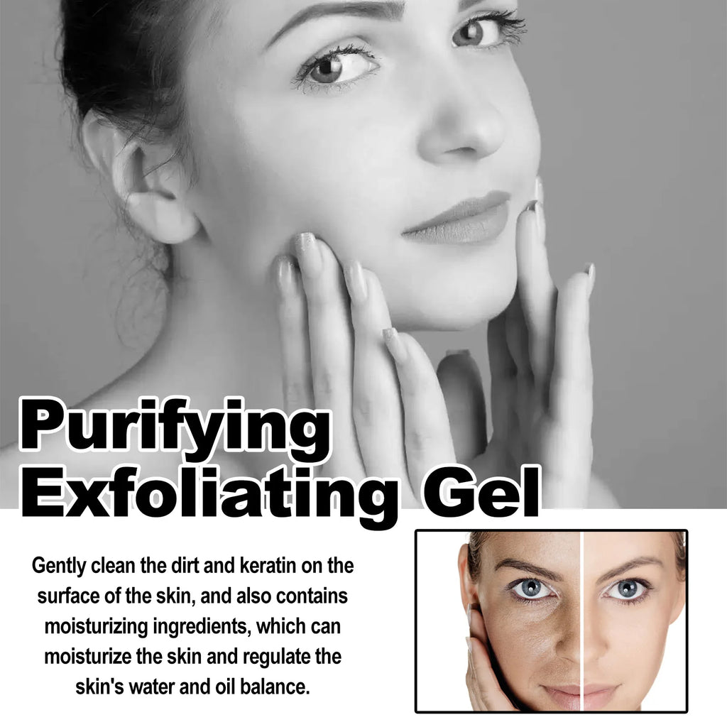 Exfoliating Peeling Gel for Acne and Blackheads - 50g Gentle Formula Scrubs Treatments Tidesmit