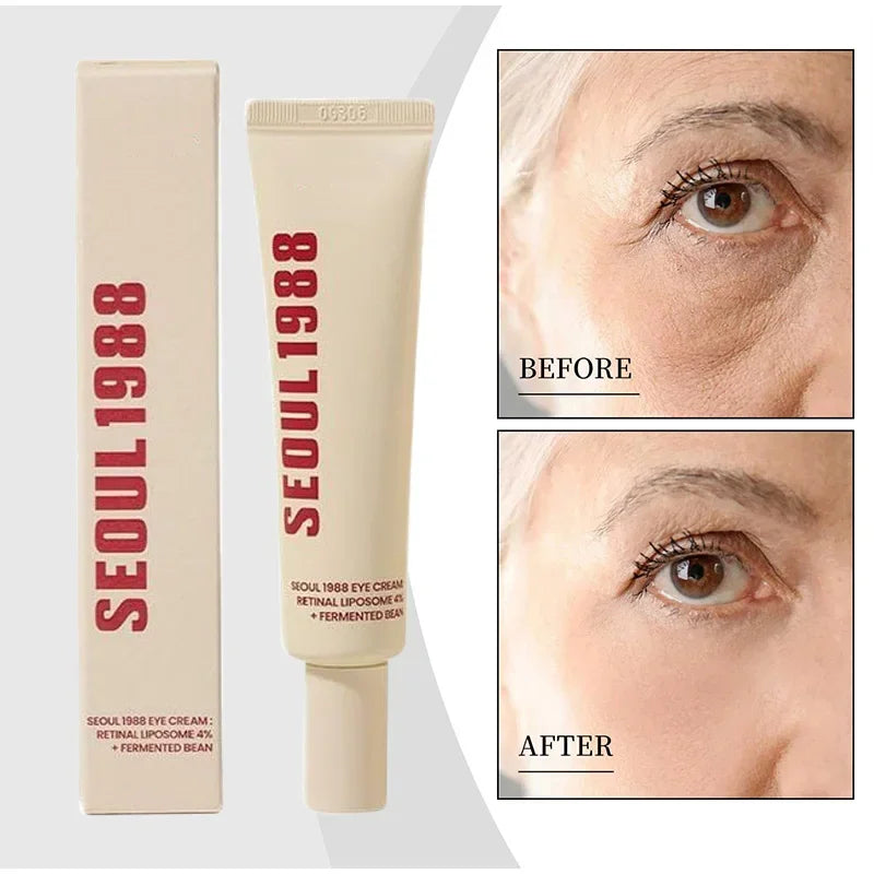Tidesmit Seoul 1988 4% Retinol Eye Cream for dark circles and wrinkles anti aging firming eye treatment for women