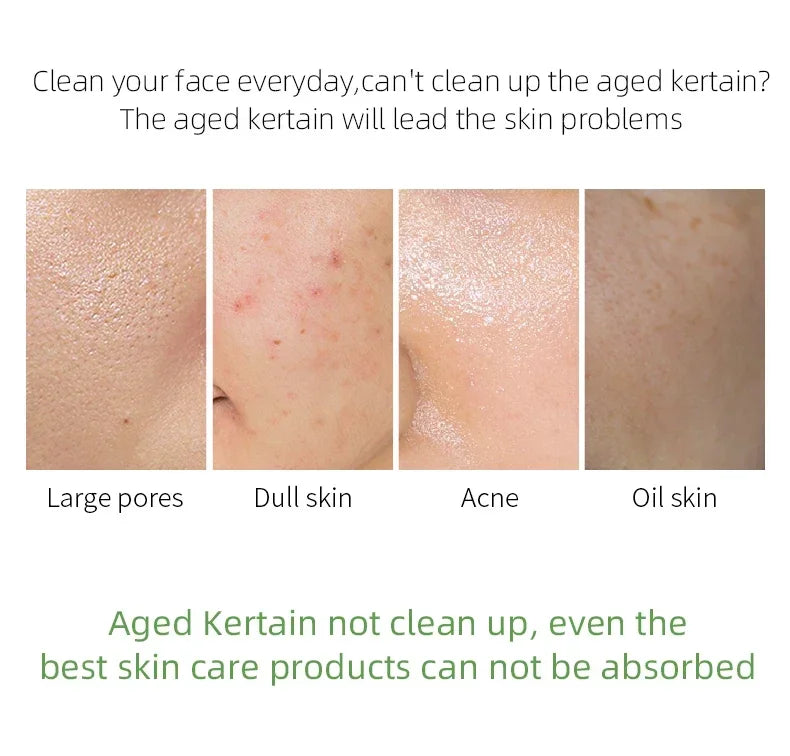 Matcha Exfoliating Peeling Gel | Deep Facial Scrub for Glowing Skin Scrubs Treatments Tidesmit