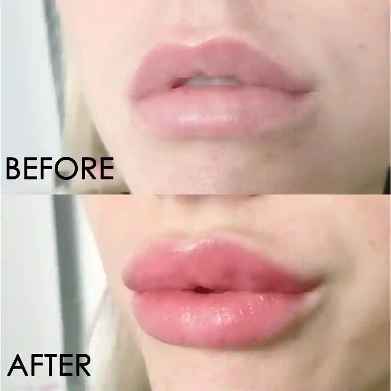 Lip Plumper Serum: Moisturizing Volumizing Treatment for Fuller Lips Lip Care Tidesmit