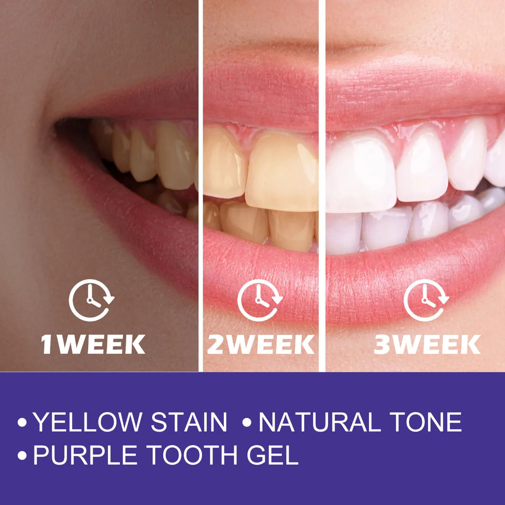 Tidesmit purple whitening toothpaste for removing yellow teeth stains and daily fresh breath oral care