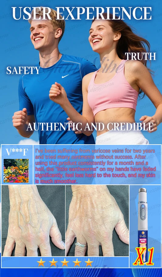 Slim cylindrical handheld device for reducing the appearance of varicose veins on skin.