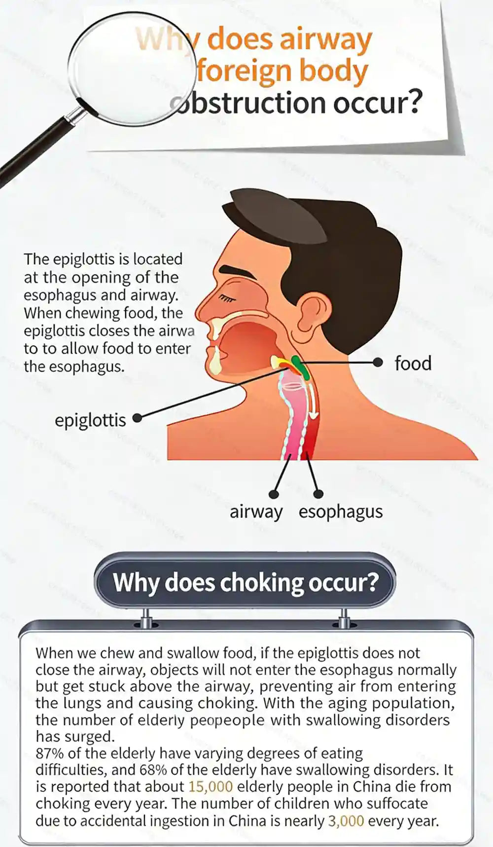 Anti Choking Device - Portable Airway Assist Kit for Emergency Safety Relaxation Treatment Tidesmit