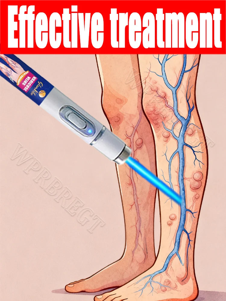 Blue Light Therapy Pen for Muscle Relief | Portable Wellness Tool Relaxation Treatment Tidesmit