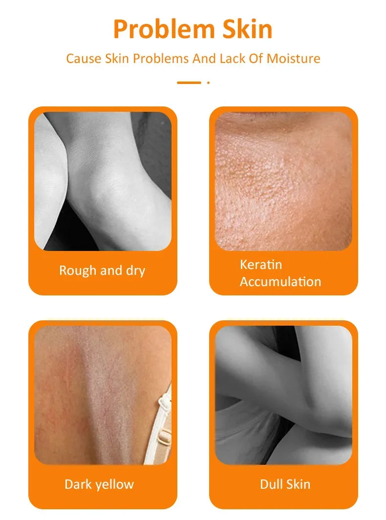 Orange Peeling Lotion for Gentle Body Exfoliation - Natural AHA Formula Scrubs Treatments Tidesmit
