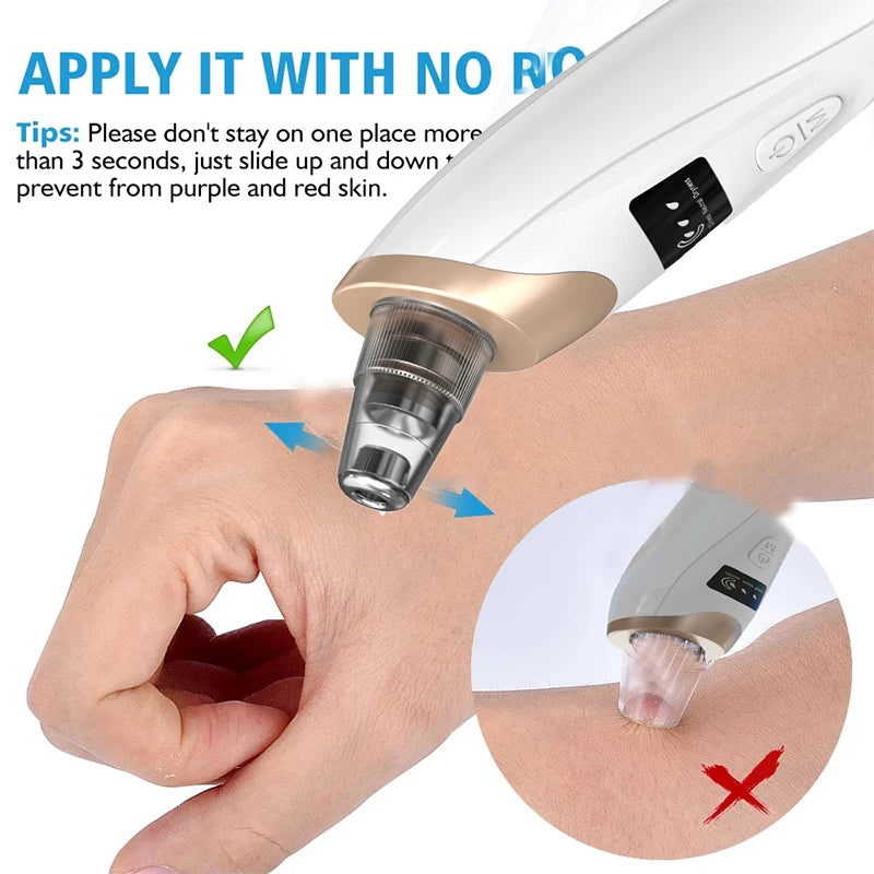 White and gold electric blackhead remover tool being tested on hand to show proper sliding motion.