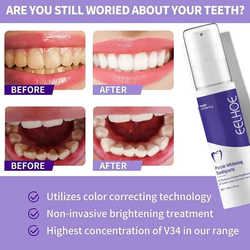 Tidesmit YG52 teeth whitening toothpaste for effective yellow stain removal and daily oral hygiene care