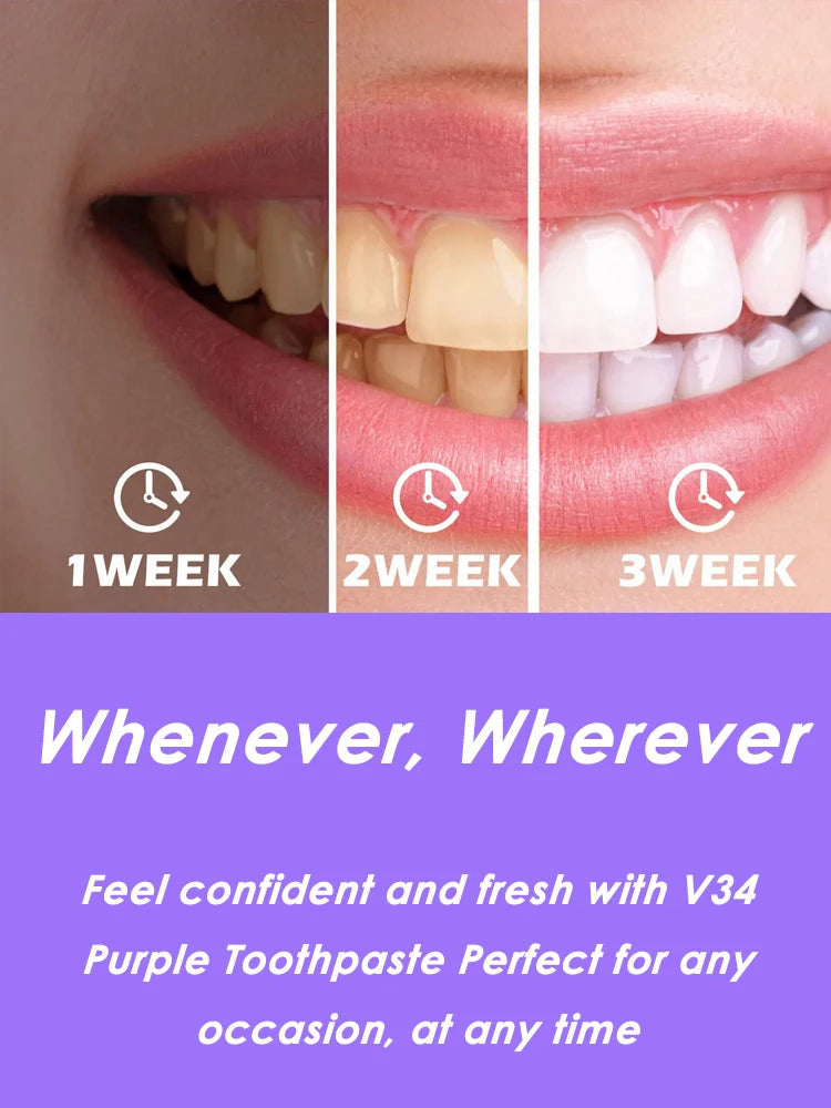 Tidesmit V34 dental whitening toothpaste for stain removal and fresh breath oral hygiene
