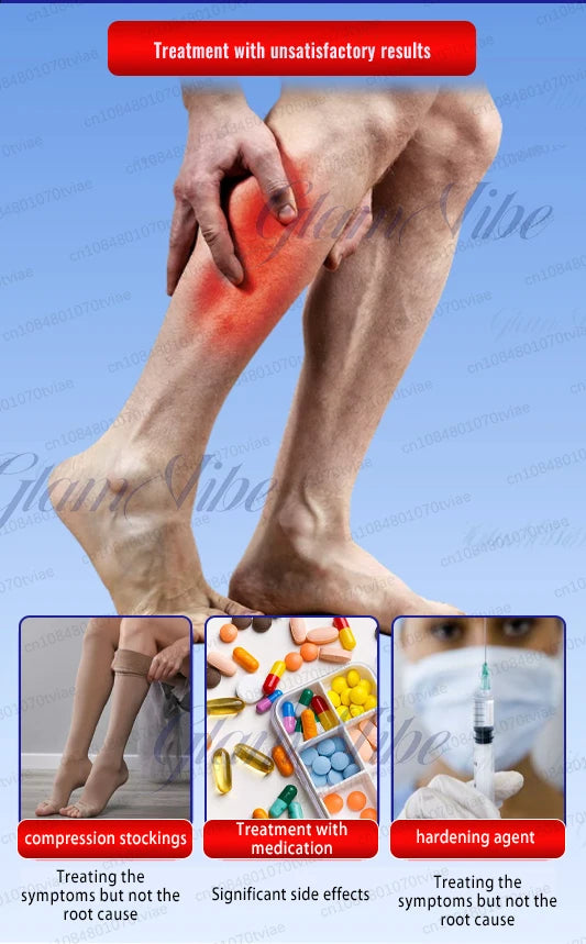 Comparison of varicose vein treatments: compression stockings, oral medication, and sclerotherapy injections.