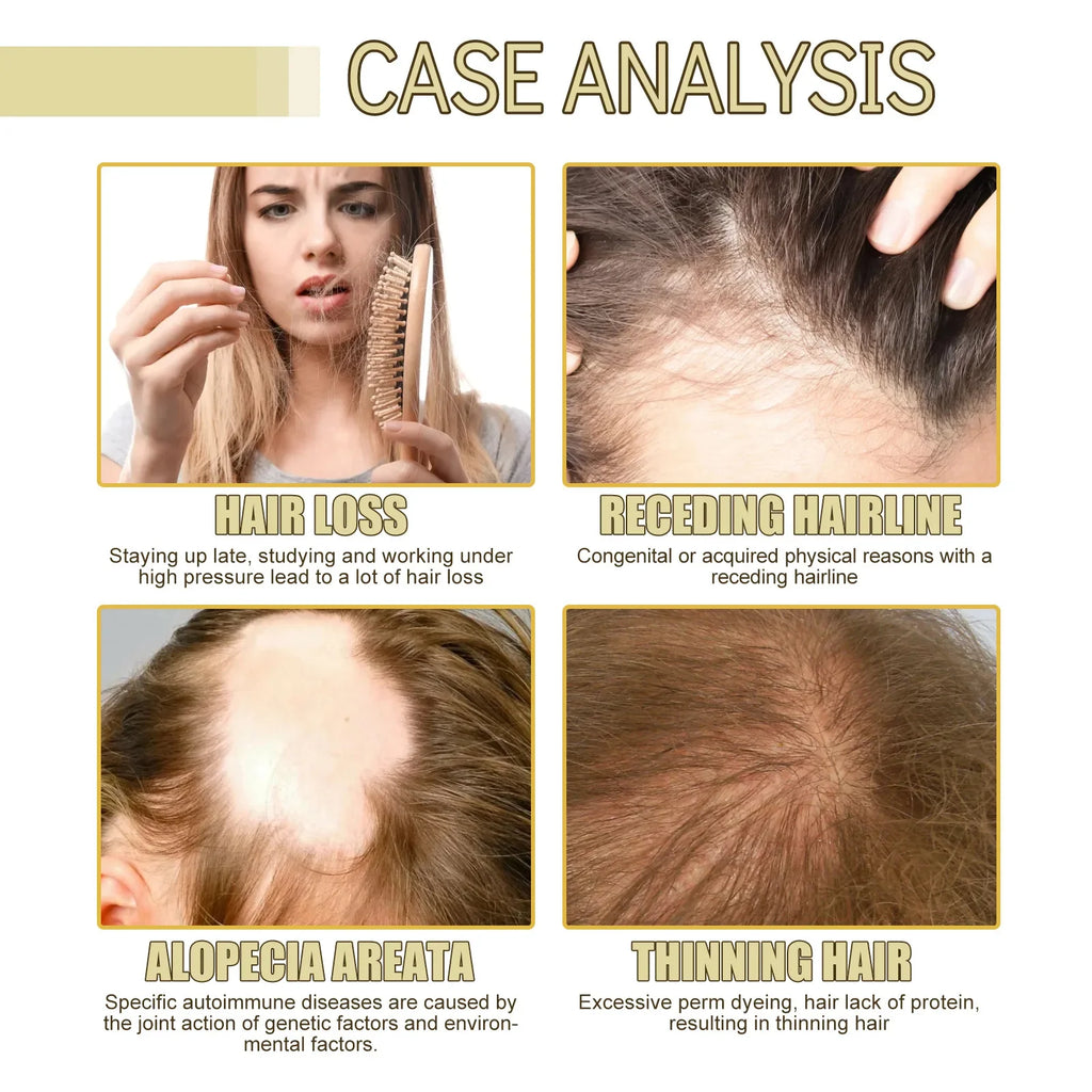 Tidesmit hair growth essential oil case analysis for thinning, receding hairlines, and alopecia scalp treatment.