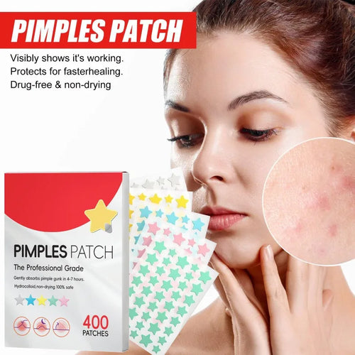 Star acne pimple cover patches, 400 count box with colorful star sticker sheet