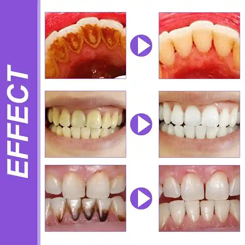 Tidesmit teeth whitening gel toothpaste for professional stain removal and fresh breath 2025