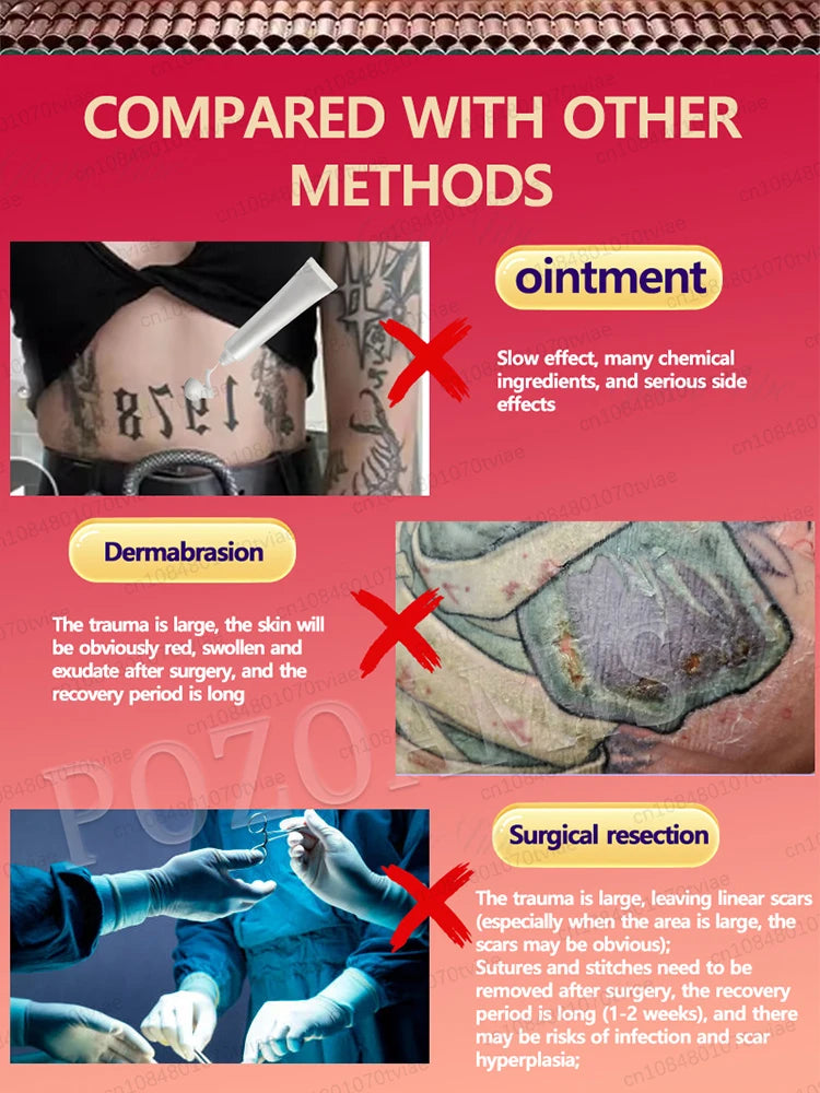 Nano Laser Tattoo Removal Machine - Professional PMU Device Permanent Makeup Machines Tidesmit