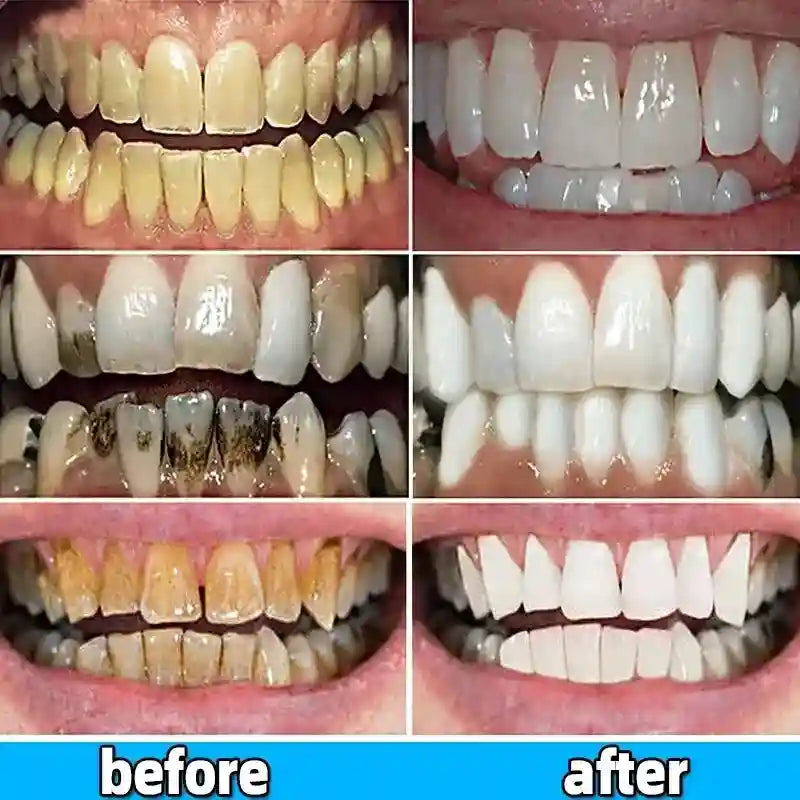 Tidesmit teeth whitening toothpaste for dental calculus removal and breath freshening oral care.