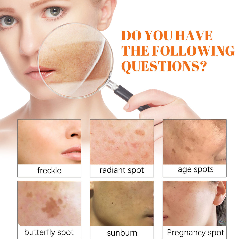 Tidesmit EELHOE papaya whitening freckle cream dark spot corrector brightening face makeup texture close-up