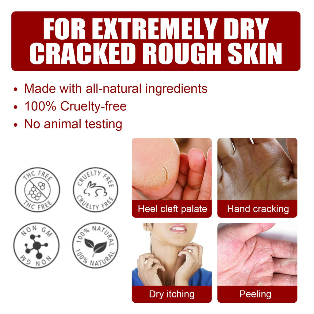 Exfoliating Foot Peel Mask - Apple Extract Callus Remover (5-15 Pack) Scrubs Treatments Tidesmit