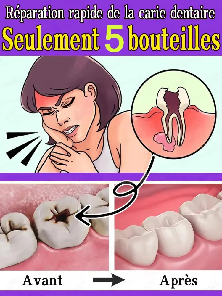 Tidesmit probiotic teeth whitening treatment for tooth decay repair and deep cleaning
