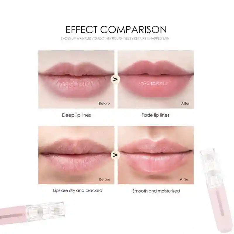 Comparison of before and after lip treatment showing reduced lines and improved moisture, plus a pink derma roller tool.