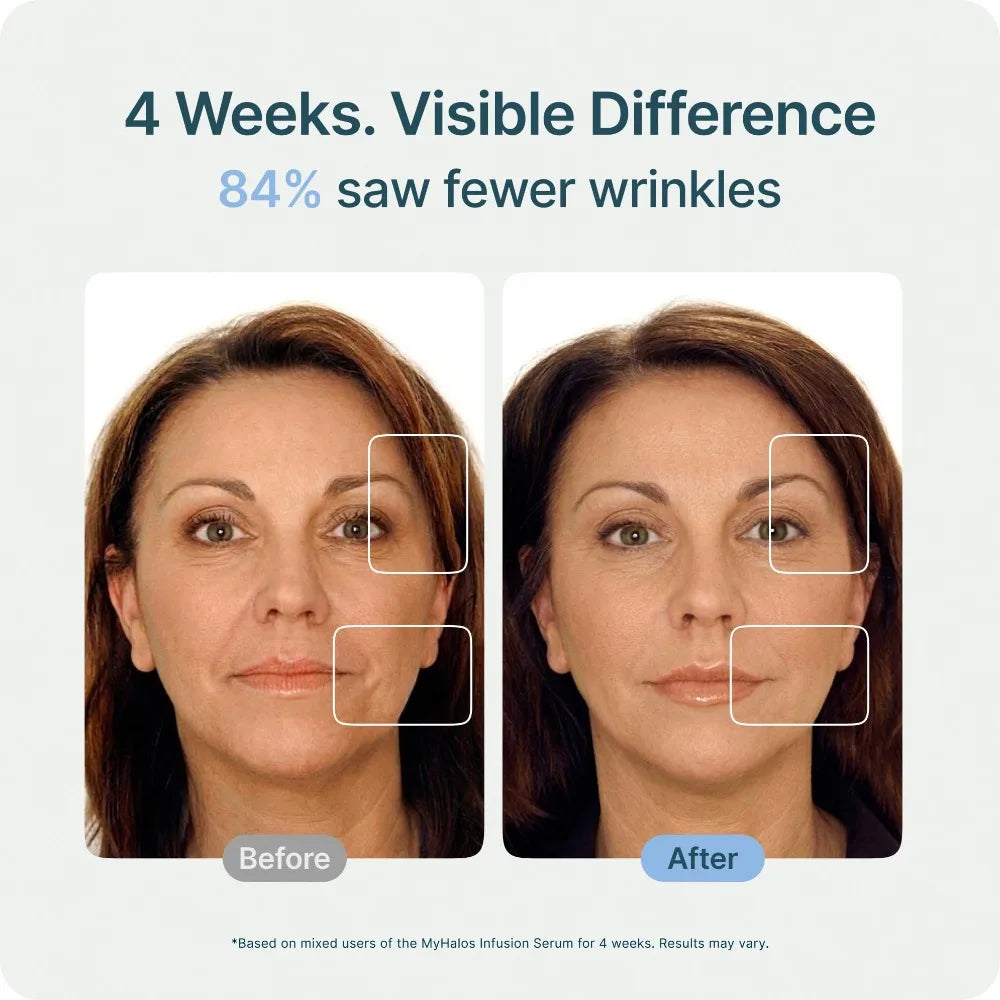 Complete Facial Care Kit 2 Tools & 6 Essence Bottles Hydrate Nourish Firm Skin Reduce Fine Lines Anti-Aging Collection