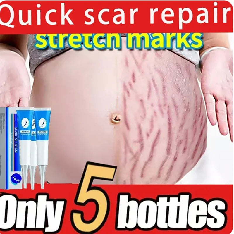 Stretch Mark Repair Cream for Pregnancy Postpartum Skin Recovery Relaxation Treatment Tidesmit