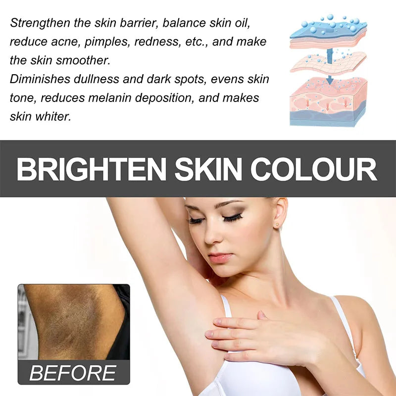 Body Whitening Cream Niacinamide Whitening Lightening Private Armpit Knee Inner Thigh Whitening Nourishing Moisturising Cream