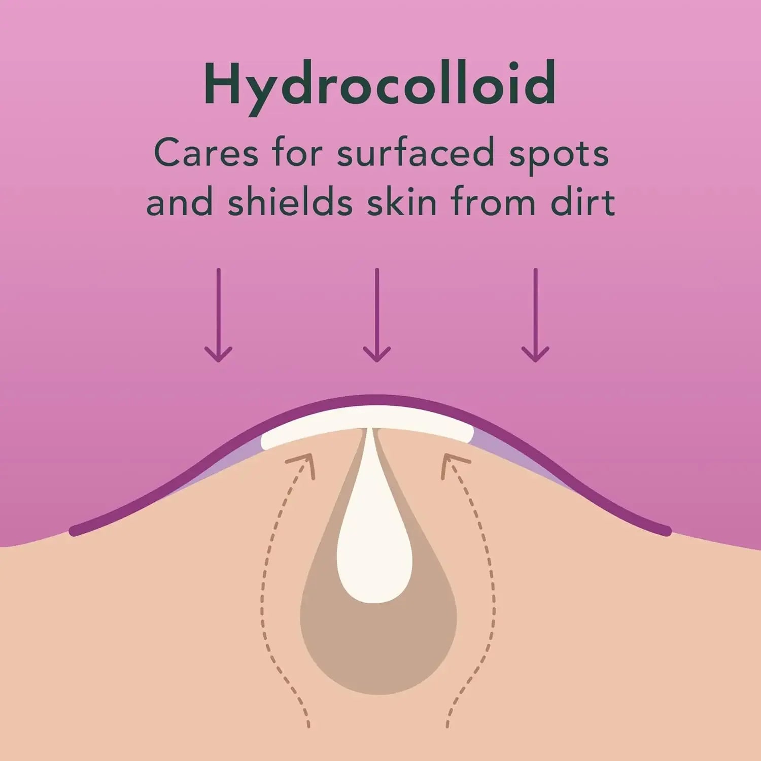 Hydrocolloid Acne Pimple Patches for Face Shrinking Zits Whiteheads Nighttime Spot Pimple Stickers for Face Skin Care Tools